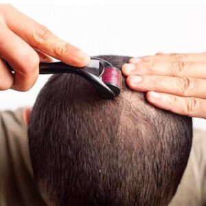 RadBizz Derma Roller and Storage Case - 0.25mm